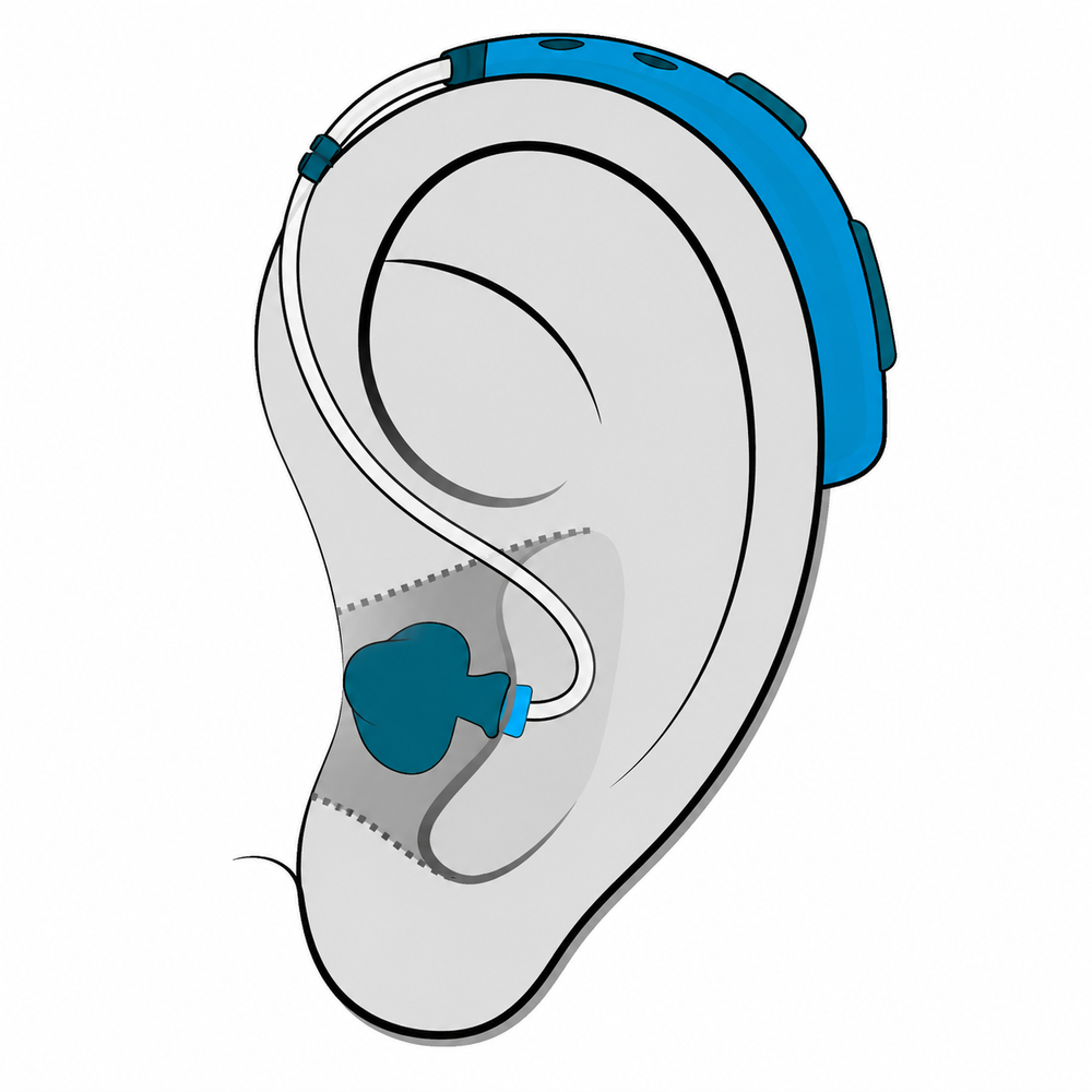 Behind-the-Ear (BTE) hearing aid style available at Better Hearing Clinic in McAllen, TX