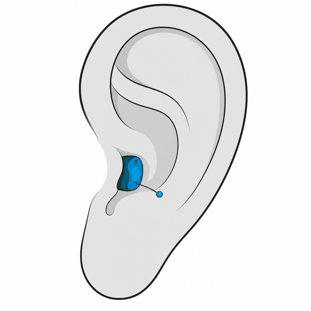 Completely-in-Canal (CIC) hearing aid style available at Better Hearing Clinic in McAllen, TX
