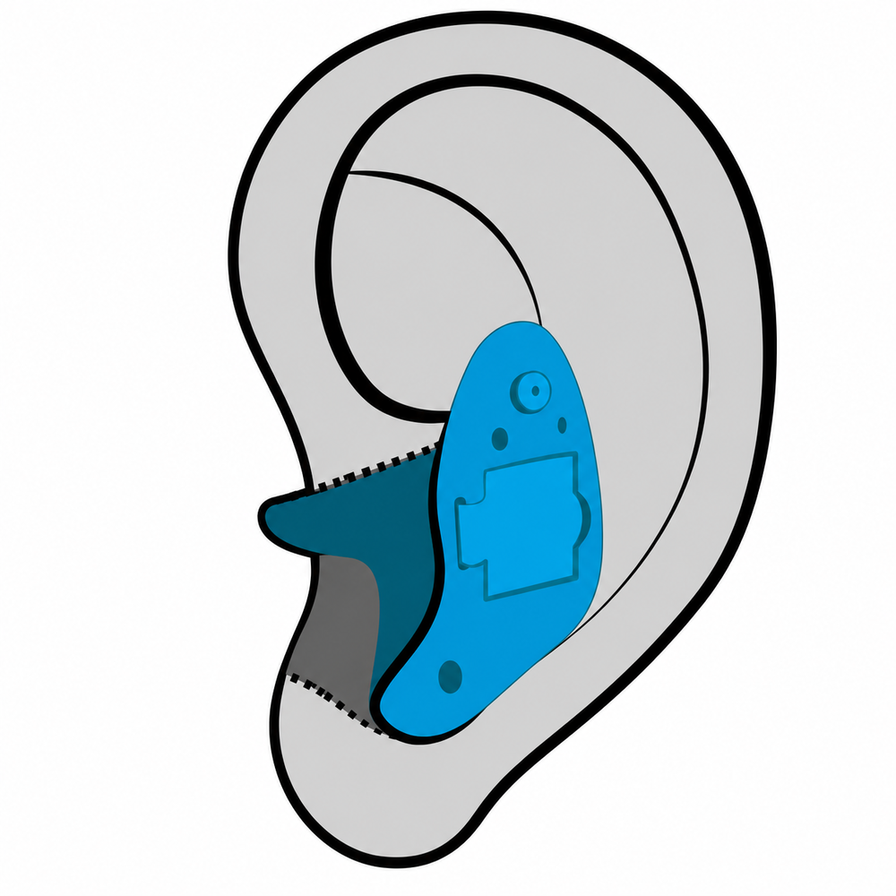In-the-Ear (ITE) hearing aid style available at Better Hearing Clinic in McAllen, TX