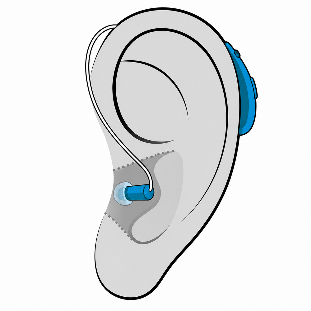 Receiver-in-Canal (RIC) hearing aid style available at Better Hearing Clinic in McAllen, TX